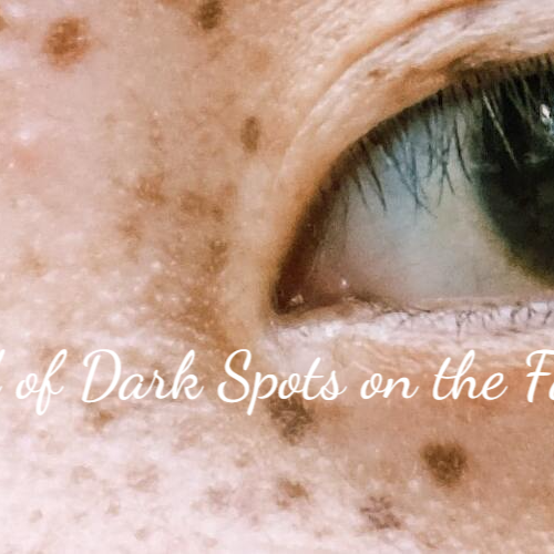 How to Get Rid of Dark Spots on the Face Naturally