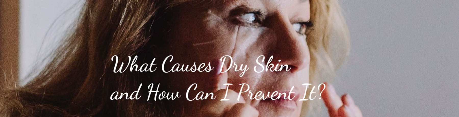 What Causes Dry Skin and How Can I Prevent It?
