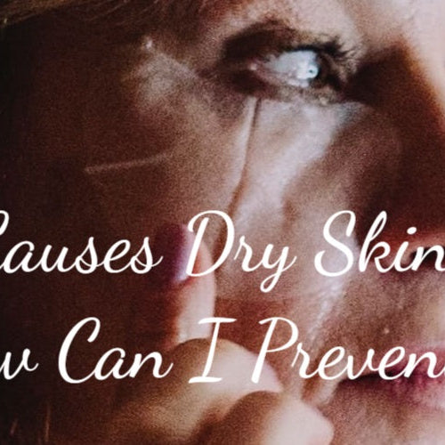 What Causes Dry Skin and How Can I Prevent It?